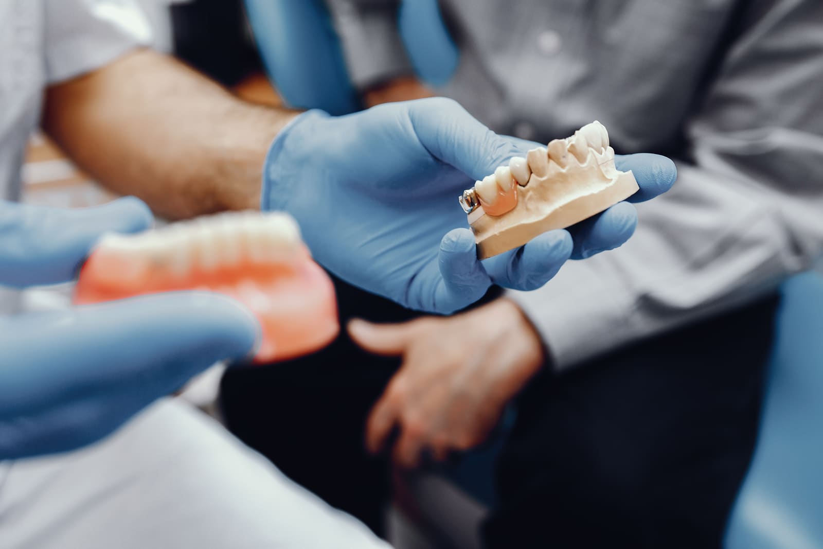 Implantes